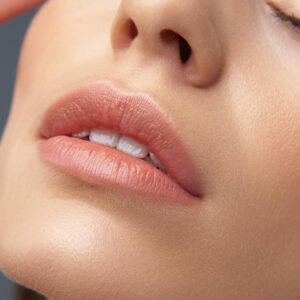 Lip Filler