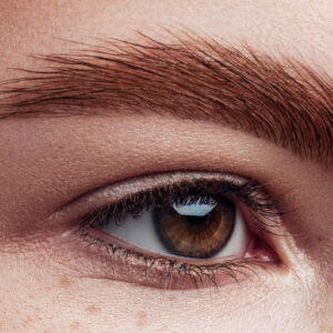 Q Switch Laser Eyebrow Removal